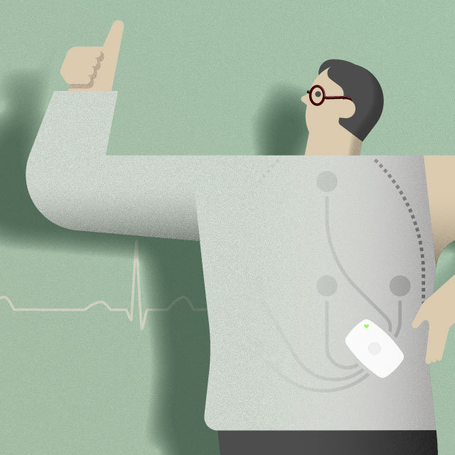 e-skin ECGホルター心電図検査サービスのイメージ