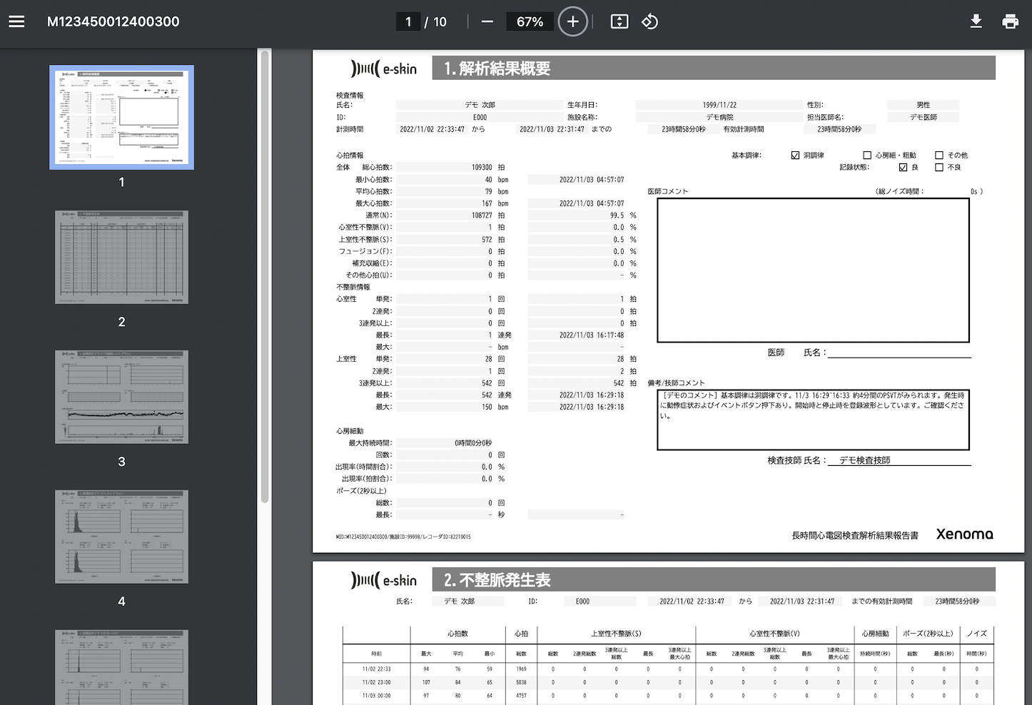 e-skin_ECGホルター心電図検査_レポート_サンプル